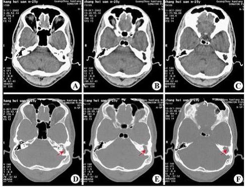 ����ͻ��Ч������������ж�����ͻ�ף����������½�